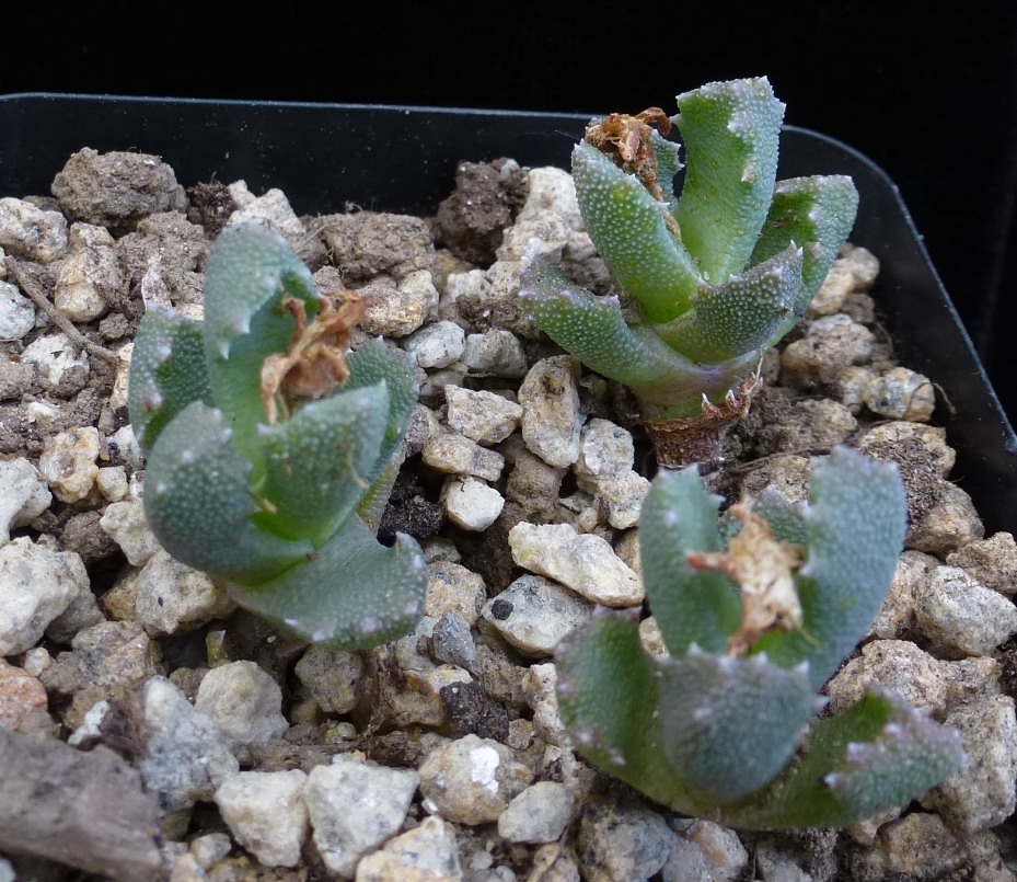 Roux's stomatium